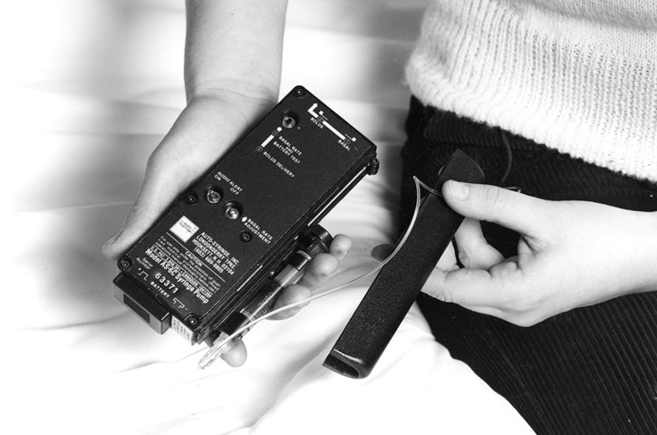 Arkivfoto af en insulinpumpe fra 1980'erne