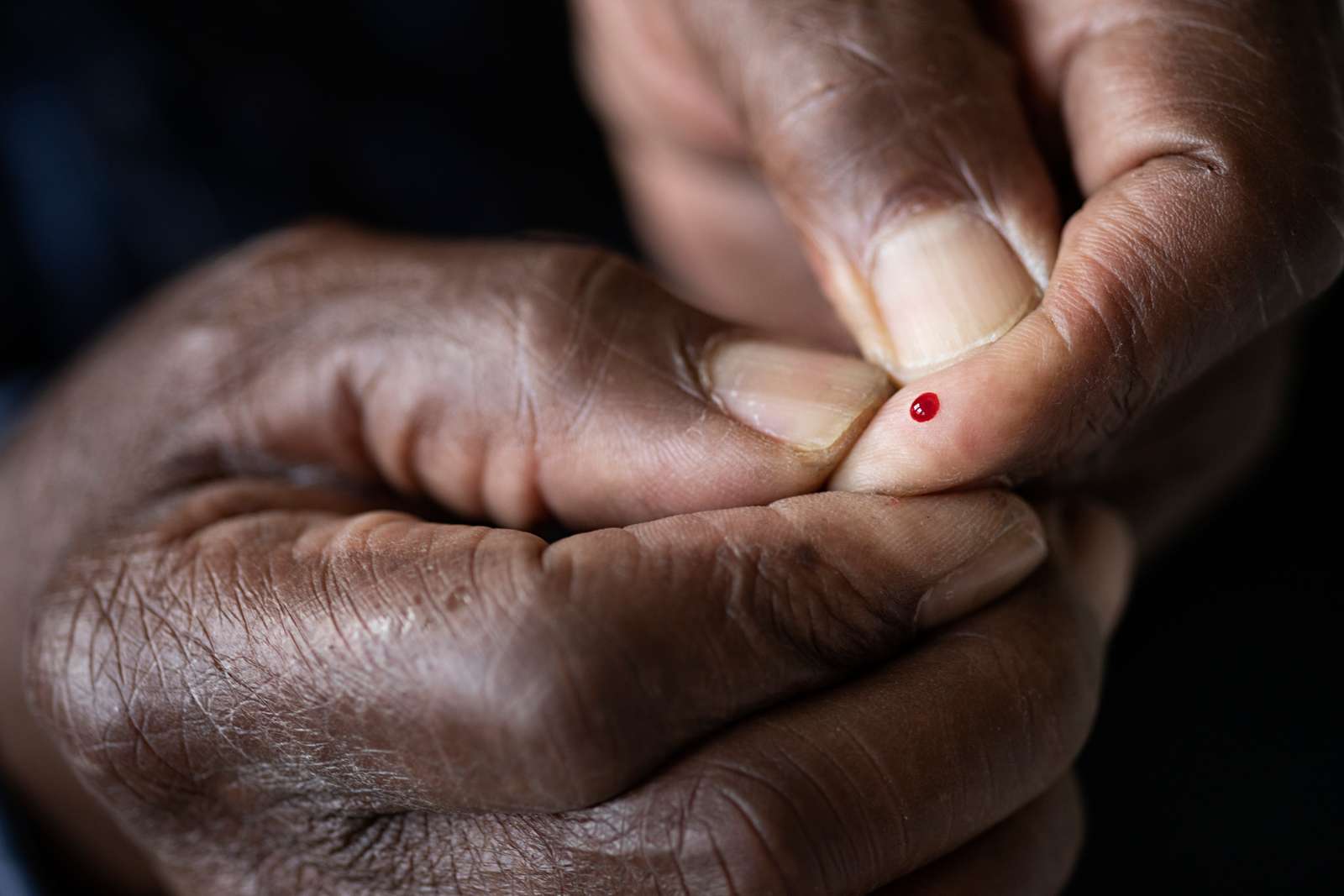 Bloddråbe fra finger