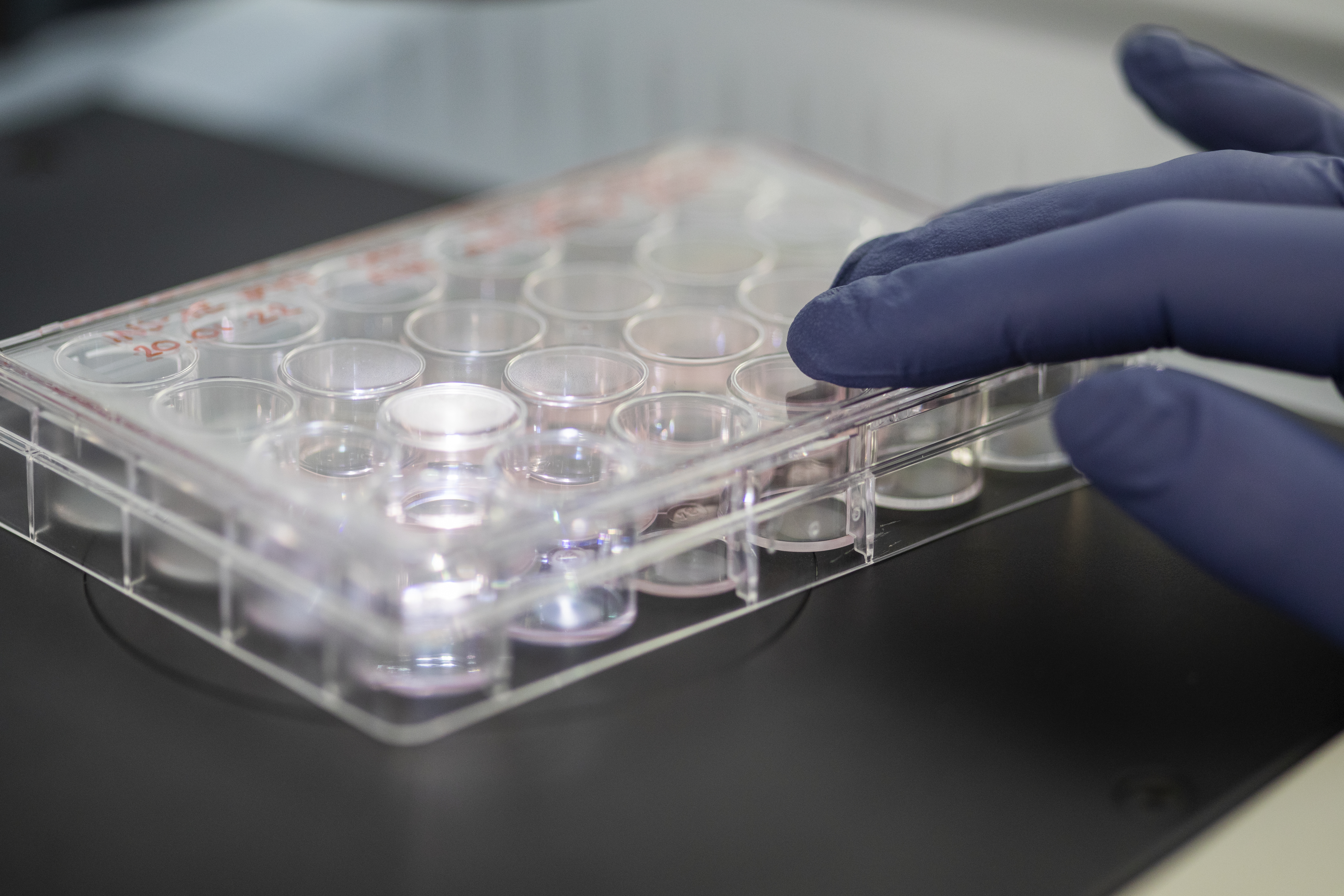 Billede af test til at identificere MODY-varianten af diabetes.