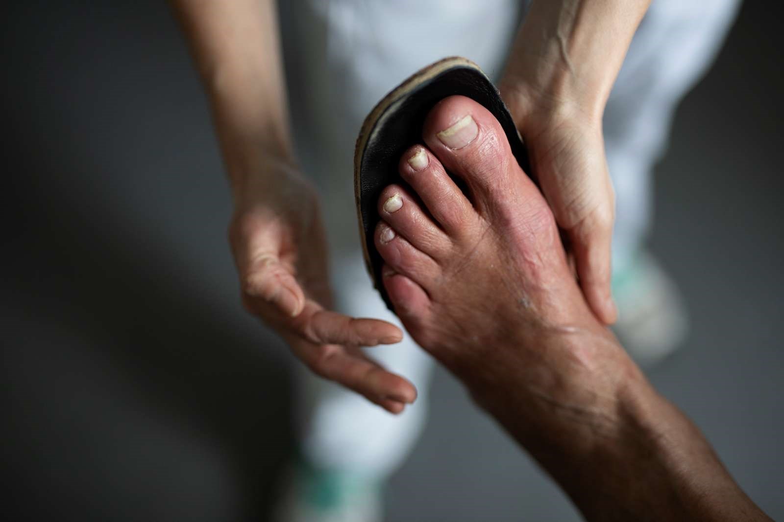 Billede af en fod, der bliver undersøgt af en behandler.