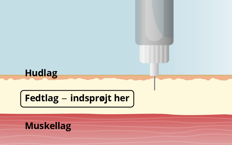 Grafisk illustration af, hvordan man injicerer insulin